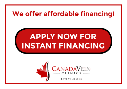 Apply for affordable financing for spider and varicose vein treatment at Canada Vein Clinics