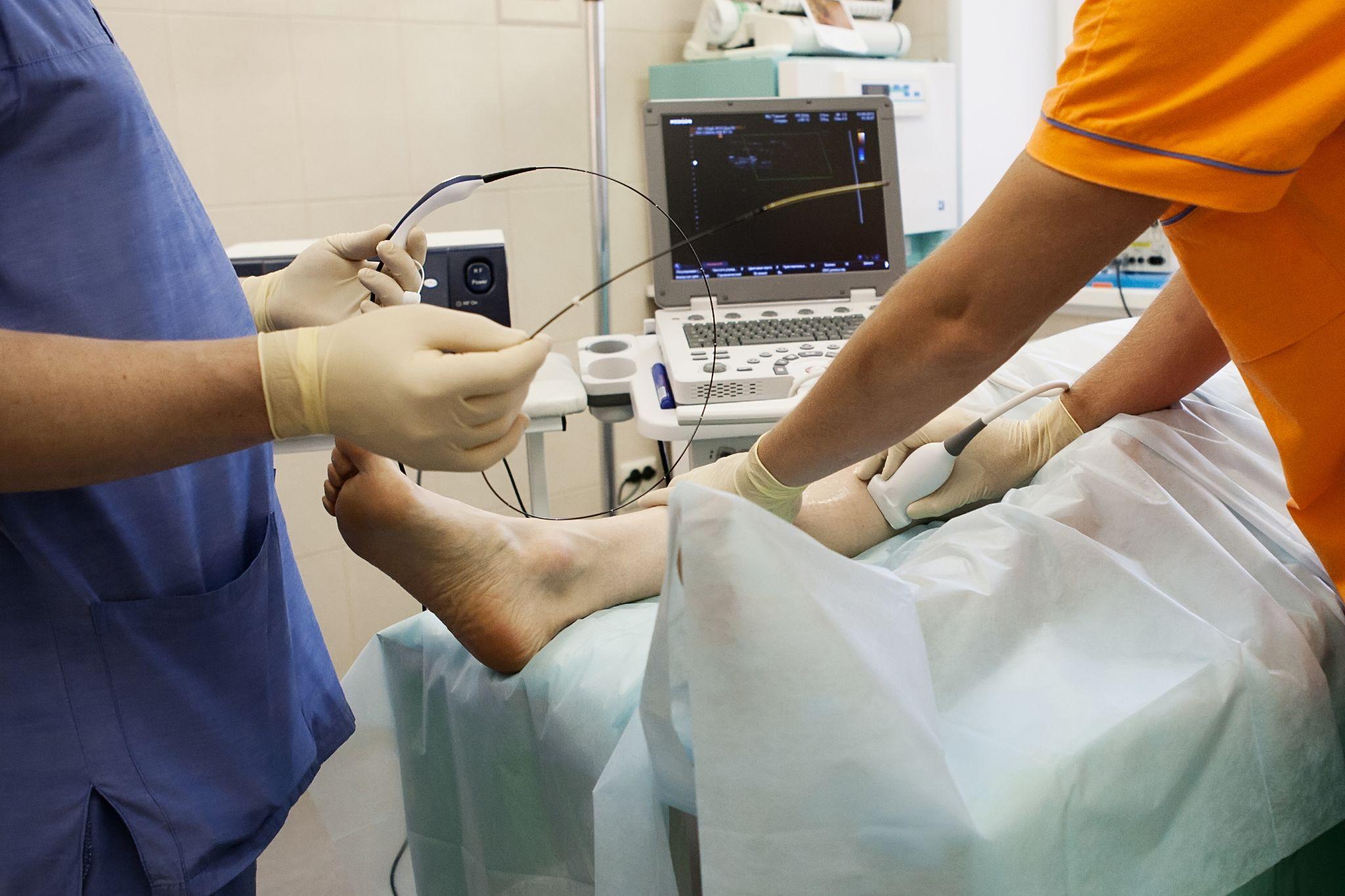 Medical Procedures for Varicose Vein Treatment - Varicose Veins