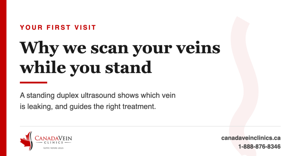 Why Canada Vein Clinics scans your veins while you stand: standing duplex ultrasound